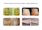 Portable Medical Laser Liposuction System Intervention Therapy For Orthopaedics supplier