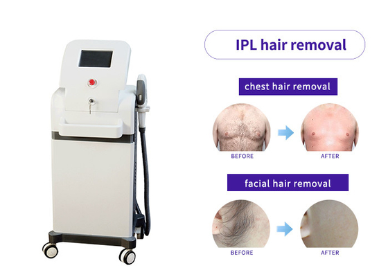 China E Light Elos Laser Hair Removal System , Two Piece Ipl Laser Hair Removal Device supplier