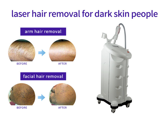 China Solid State Laser Hair And Tattoo Removal Machine , Industrial Laser Hair Removal Machine supplier