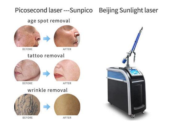 China Vertical Picosecond Laser Tattoo Removal Machine Pigmentation Removal Acne Treatment supplier