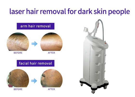 All Skin Types Thread Vein Removal Machine , Vertical Style Laser Acne Removal Machine supplier