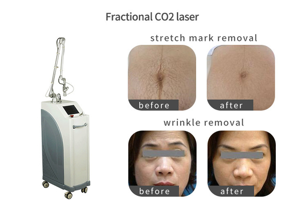 Clinic Salon Laser Beauty Equipment Multifunctional For Scar Removal supplier