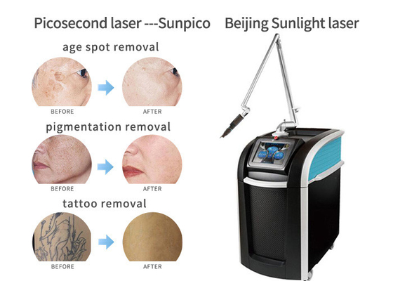 Pigments Tattoo Removal Machine , Fast Effective Laser Tattoo Removal Equipment  supplier