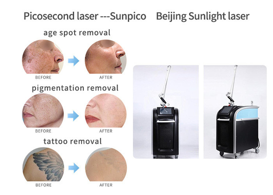 Ultra - Short Pulses Picosecond Laser Tattoo Removal Machine 1064nm / 532nm / 755nm supplier