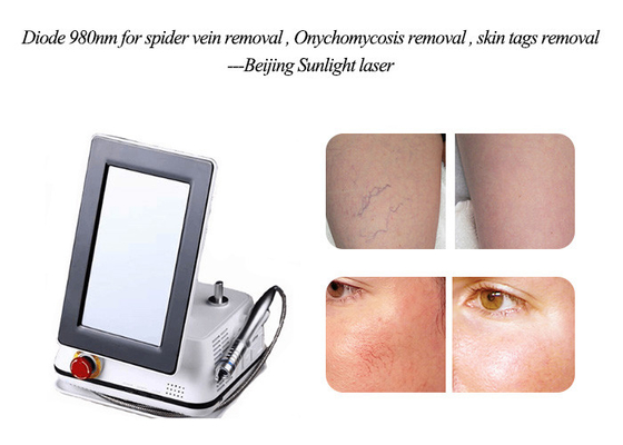 980nm Diode Laser Spider Vein Removal Machine 10W Painfree For Salon supplier