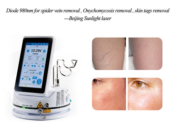 Small Design Spider Vein Removal Machine 30 Watts Output Laser Power supplier