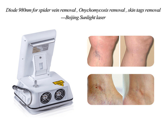 Handle Detachable Spider Vein Laser Machine , Portable Laser Vein Removal Machine supplier