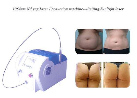 Portable Medical Laser Liposuction System Intervention Therapy For Orthopaedics supplier